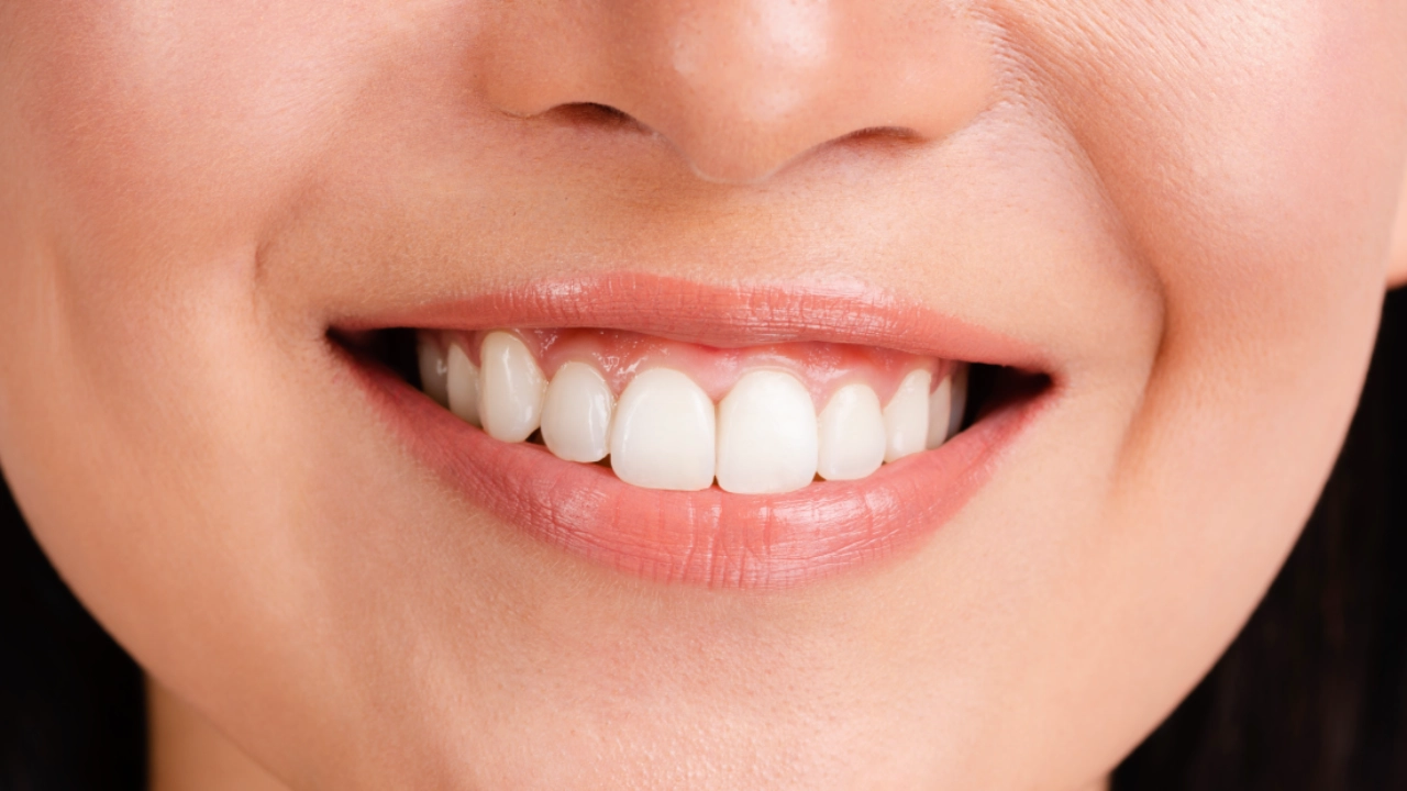 An extreme close-up of perfectly white, immaculate teeth.